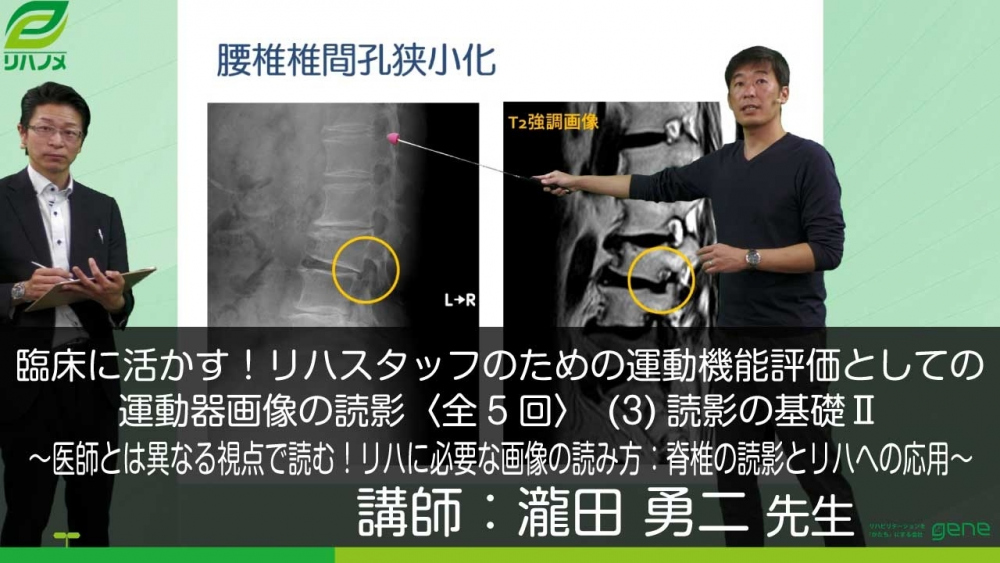 【5-3】臨床に活かす!リハスタッフのための運動機能評価としての運動器画像の読影(3)医師とは異なる視点で読む!リハに必要な画像の読み方:脊椎の読影とリハへの応用