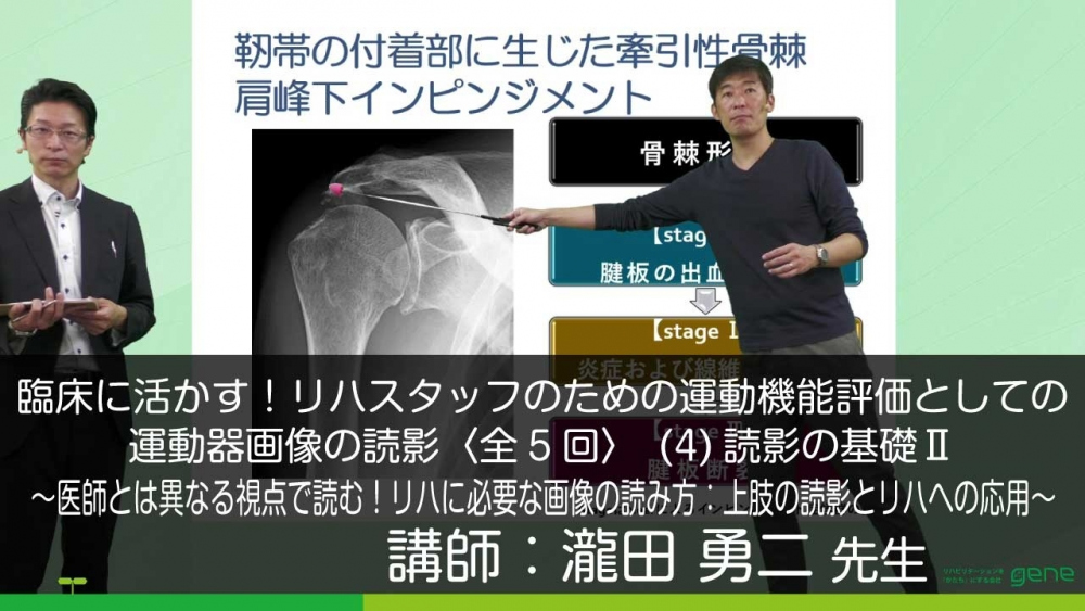 【5-4】臨床に活かす!リハスタッフのための運動機能評価としての運動器画像の読影〈全5回〉(4)医師とは異なる視点で読む!リハに必要な画像の読み方:上肢の読影とリハへの応用