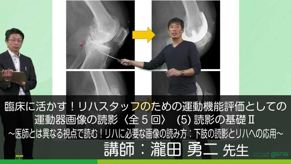 【5-5】臨床に活かす!リハスタッフのための運動機能評価としての運動器画像の読影〈全5回〉(5)医師とは異なる視点で読む!リハに必要な画像の読み方:下肢の読影とリハへの応用