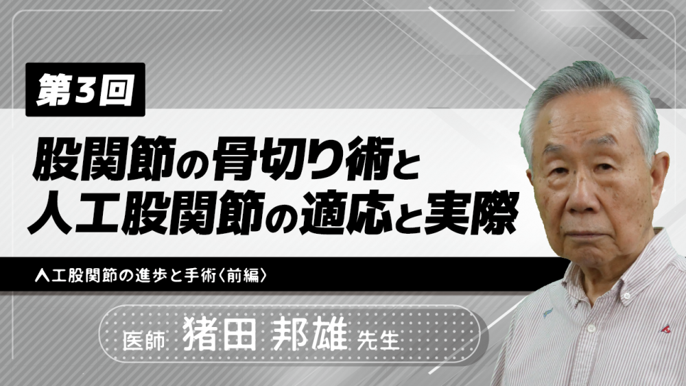 【4-3】〈全4回〉股関節の骨切り術と人工股関節の適応と実際(3)人工股関節の進歩と手術〈前編〉