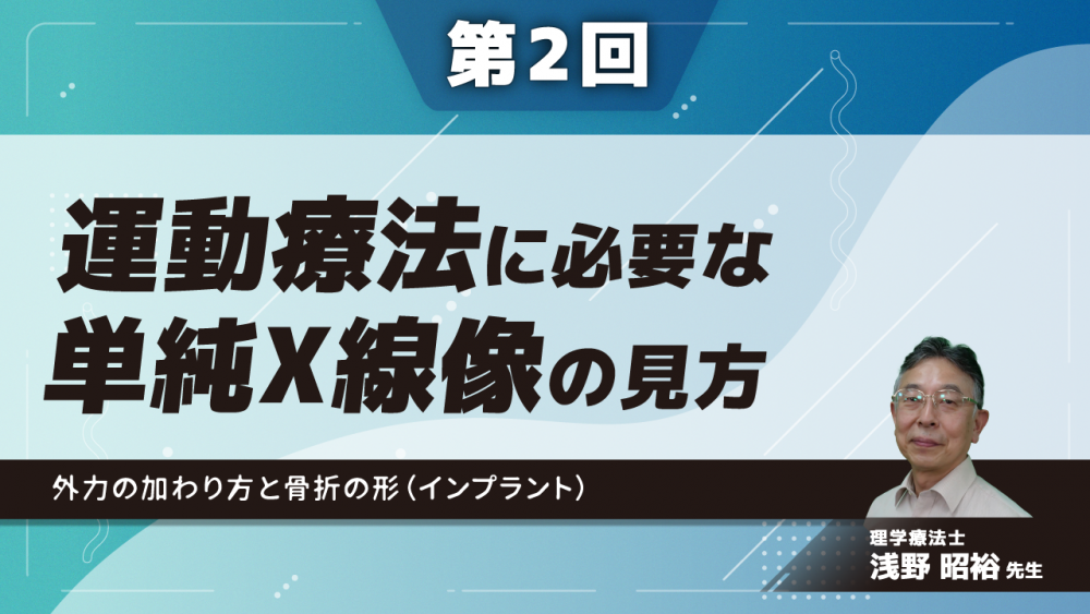 【第2回】運動療法に必要な単純X線像の見方 外力の加わり方と骨折の形(インプラント)