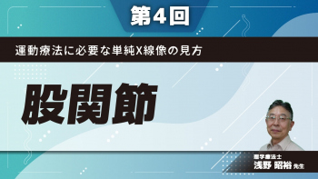 【第4回】運動療法に必要な単純X線像の見方 股関節