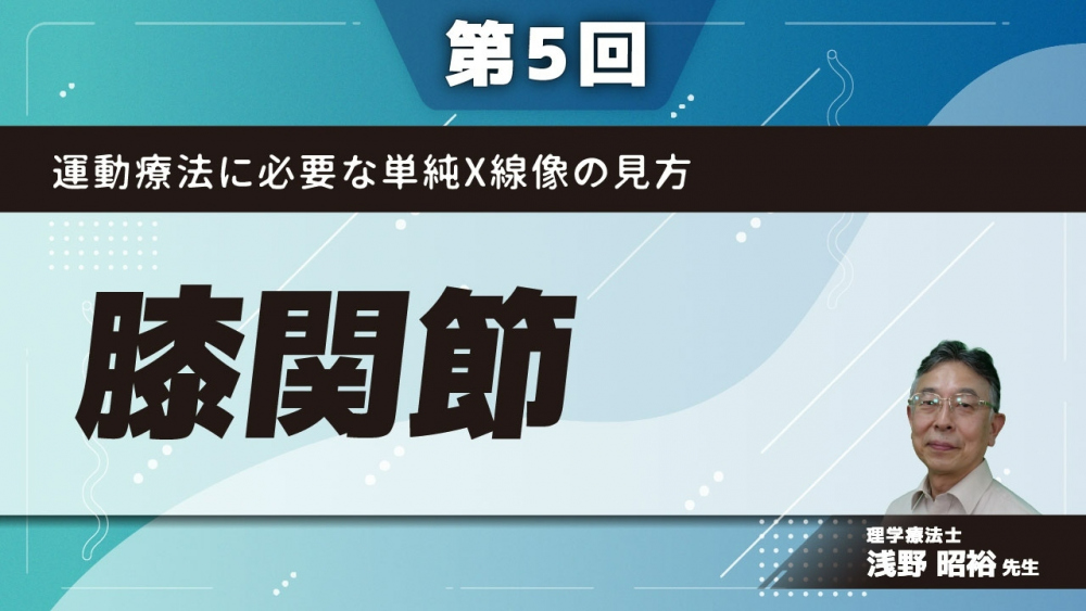 【第5回】運動療法に必要な単純X線像の見方 膝関節