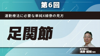 【第6回】運動療法に必要な単純X線像の見方 足関節