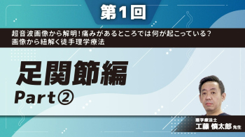 【第1回】超音波画像から解明!痛みがあるところでは何が起こっている?画像から紐解く徒手理学療法 足関節編 Part②