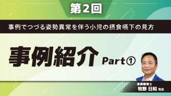 【第2回】事例でつづる姿勢異常を伴う小児の摂食嚥下の見方 ~事例紹介~ ①アセスメントの仕方(演繹法)