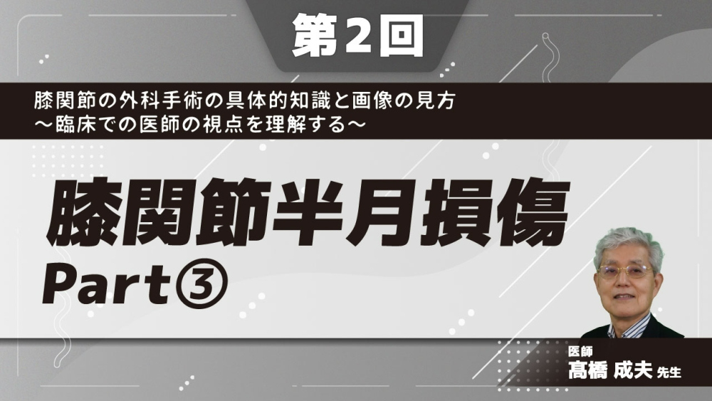 【第2回】膝関節の外科手術の具体的知識と画像の見方〜臨床での医師の視点を理解する〜 膝関節半月損傷 Part③実際の治療と限界(2)