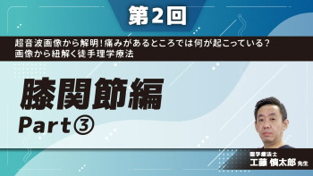 【第2回】超音波画像から解明!痛みがあるところでは何が起こっている?画像から紐解く徒手理学療法 膝関節編 Part③