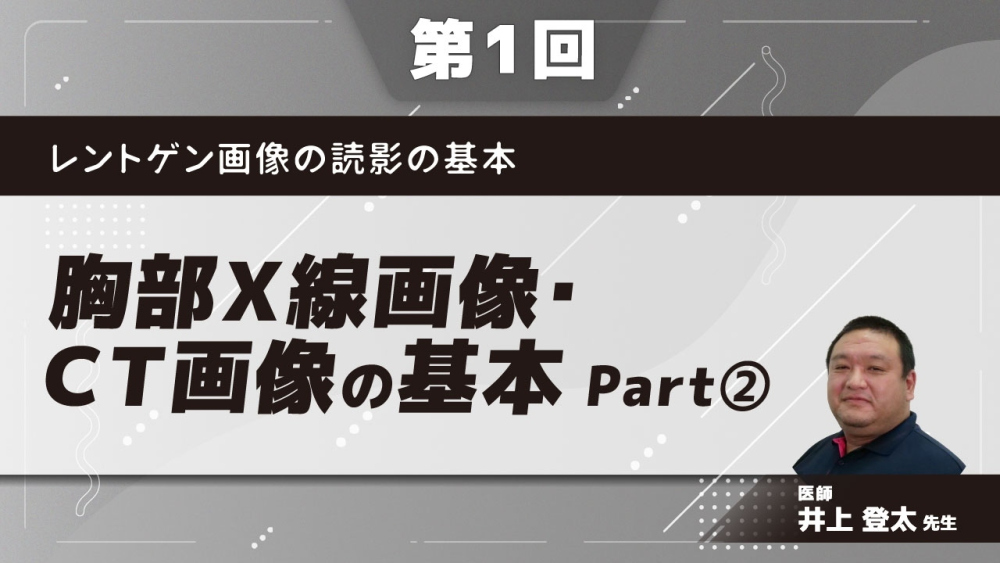 レントゲン画像の読影の基本 【第1回】胸部X線画像・CT画像の基本 Part②簡易読影法手順