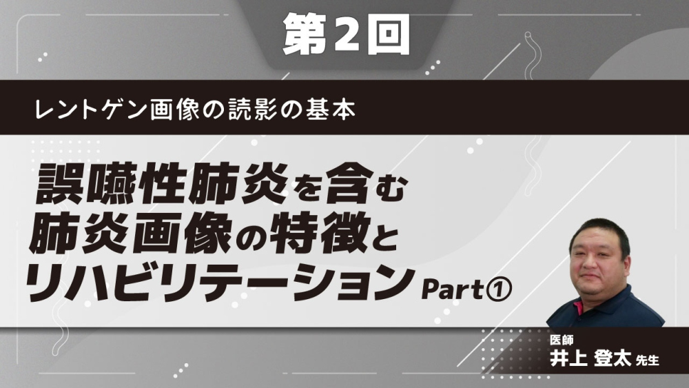 レントゲン画像の読影の基本 【第2回】誤嚥性肺炎を含む肺炎画像の特徴とリハビリテーション Part①肺炎の分類