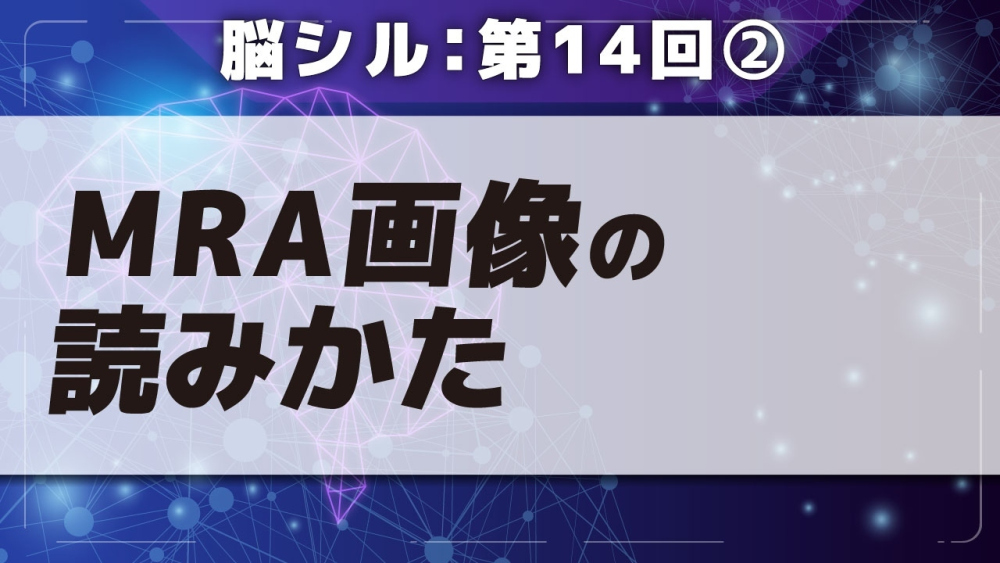 脳シル【第14回】脳動脈の見かた Part②MRA画像の読みかた