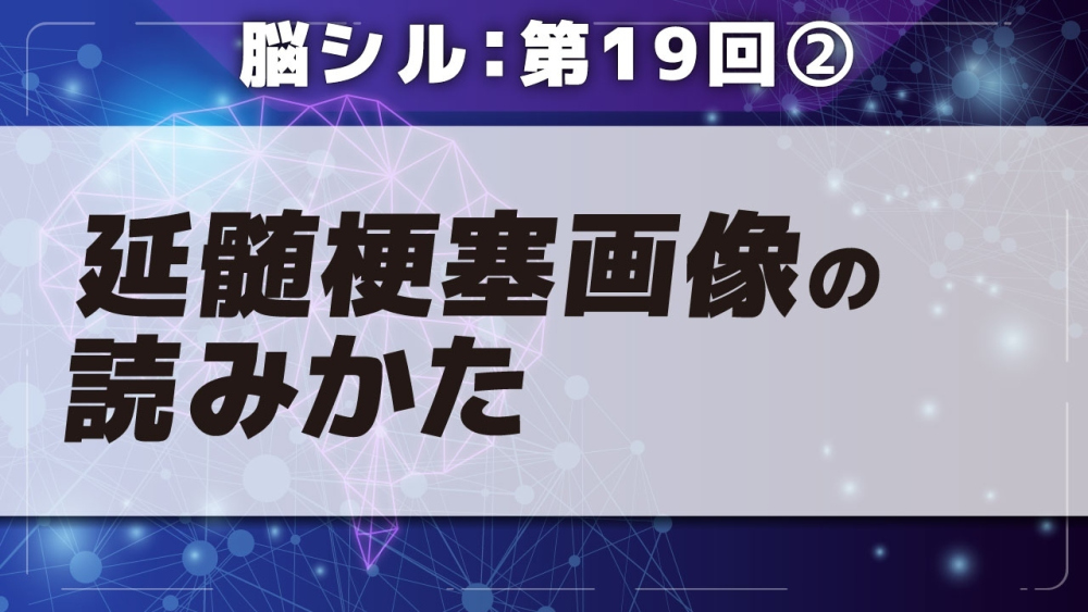 脳シル【第19回】橋梗塞・延髄梗塞の脳画像読影 Part②延髄梗塞画像の読みかた