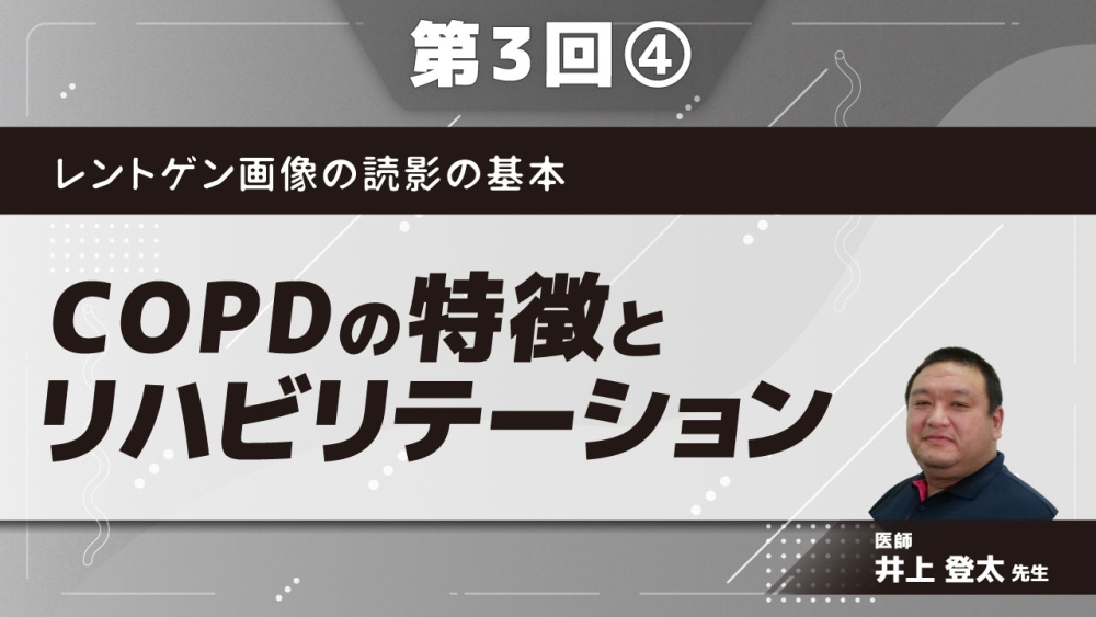 レントゲン画像の読影の基本 【第3回】COPDの特徴とリハビリテーション Part④COPDの治療2